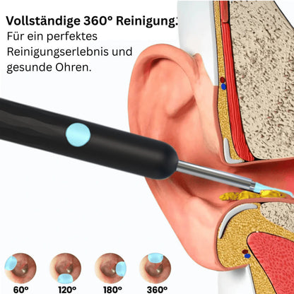 ⏳Begrenzte Zeit 50% Rabatt💥Intelligenter wasserdichter visueller Ohrenschmalzentferner👂