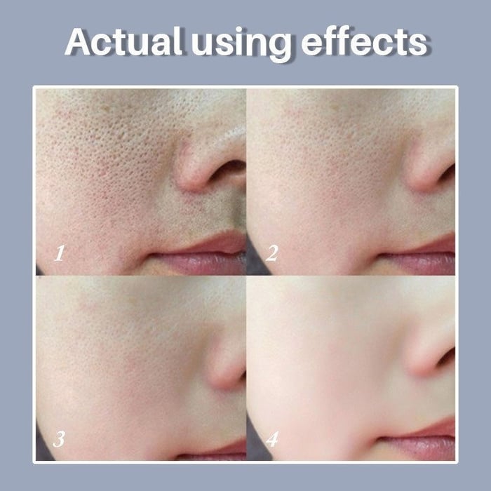 🎁Venta caliente 50% de descuento🔥Prebase facial Magical Perfection