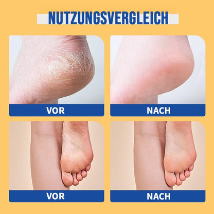 🔥Feuchtigkeitsspendende und rissfreie Fußcreme
