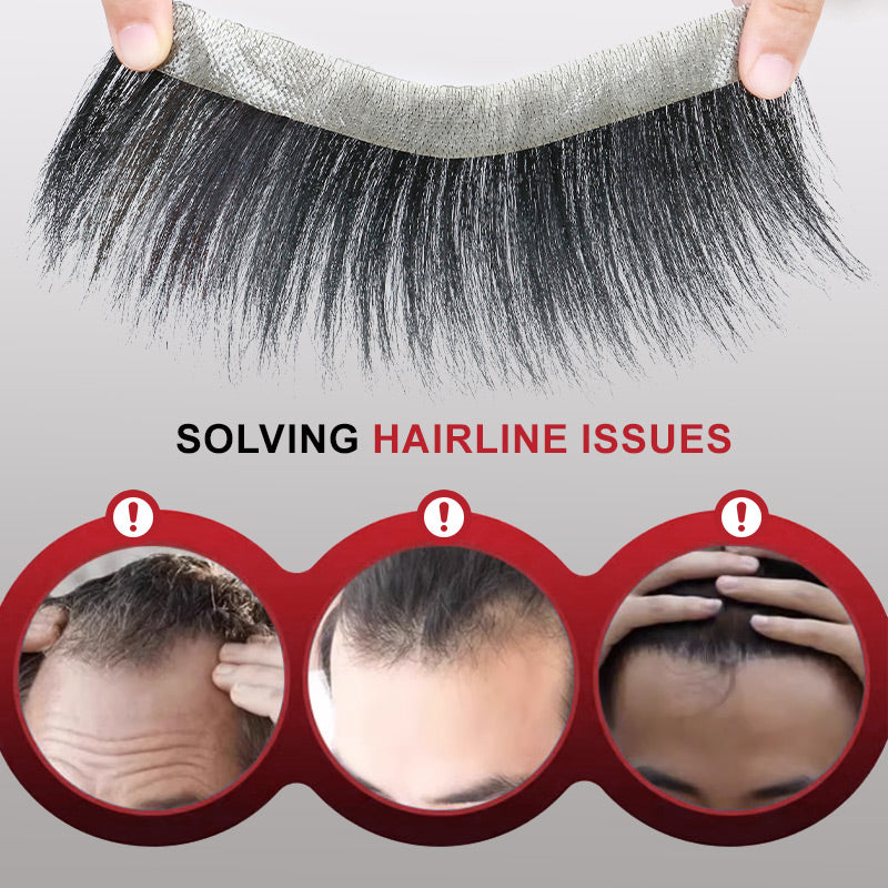 Men forehead pony wig patch （50% from）