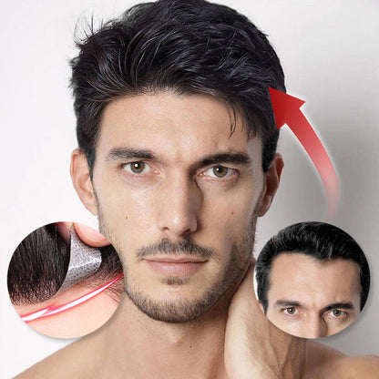 Men forehead pony wig patch （50% from）