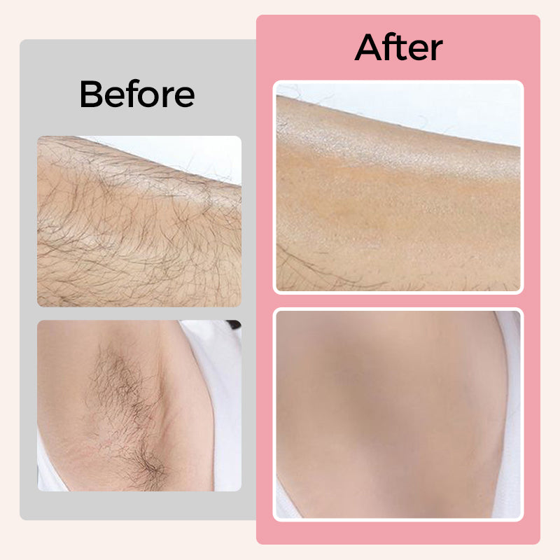 🙋‍♀️2025 Spring Promotion💖Cleansing &amp; Softening Hair Removal Cream Set