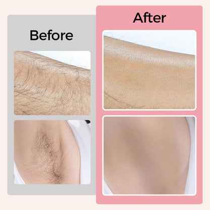 🙋‍♀️2025 Spring Promotion💖Cleansing &amp; Softening Hair Removal Cream Set