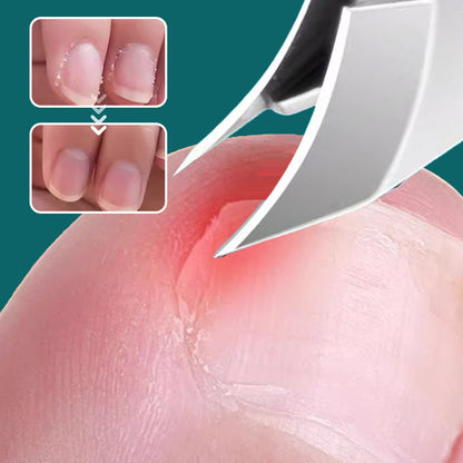 💅 JETZT 50 % RABATT! ✨ Spritzschutz-Nagelknipser-Set mit 25°-Schrägklinge, 3-teilig – Präziser Schnitt, komfortabler Griff & sicherer Spritzschutz ✂️