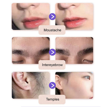 💗Achetez-en 1, obtenez-en 1 gratuitement💗Crème dépilatoire douce et indolore pour le visage