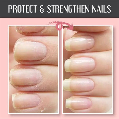 🌟2025 Schutzgel für Nagelreparatur💅 kaufen 2 Holen Sie sich 1 kostenlos