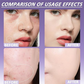 ⏳Zeitlich begrenzter Rabatt💥Matte Concealer für Gesicht & Körper