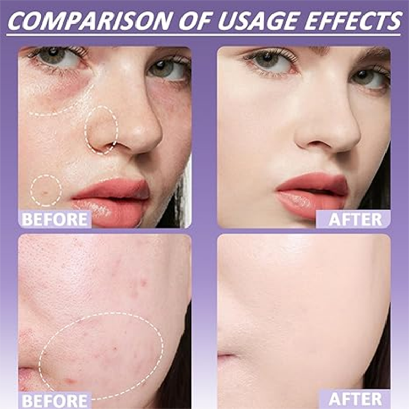 ⏳Zeitlich begrenzter Rabatt💥Matte Concealer für Gesicht & Körper