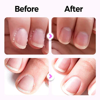 🚀Bestseller! 50% OFF – Automatische Nagelfeile für sanfte & sichere Pflege 🎉