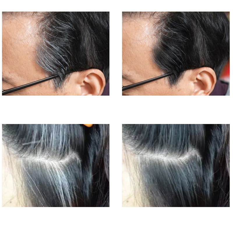 🔥Solange der Vorrat reicht 40 % Rabatt!🎉Kamm zum sofortigen Ausbessern der Haarfarbe
