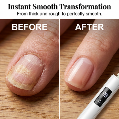 💎 NUR FÜR BEGRENZTE ZEIT: 50 % RABATT! ✨Professionelle elektrische Nagelfeile