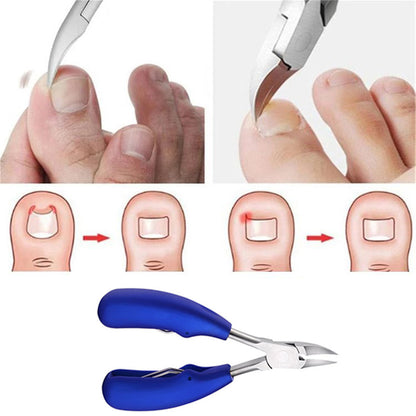 Präziser & ultrascharf Nagelschneider ✂️💅